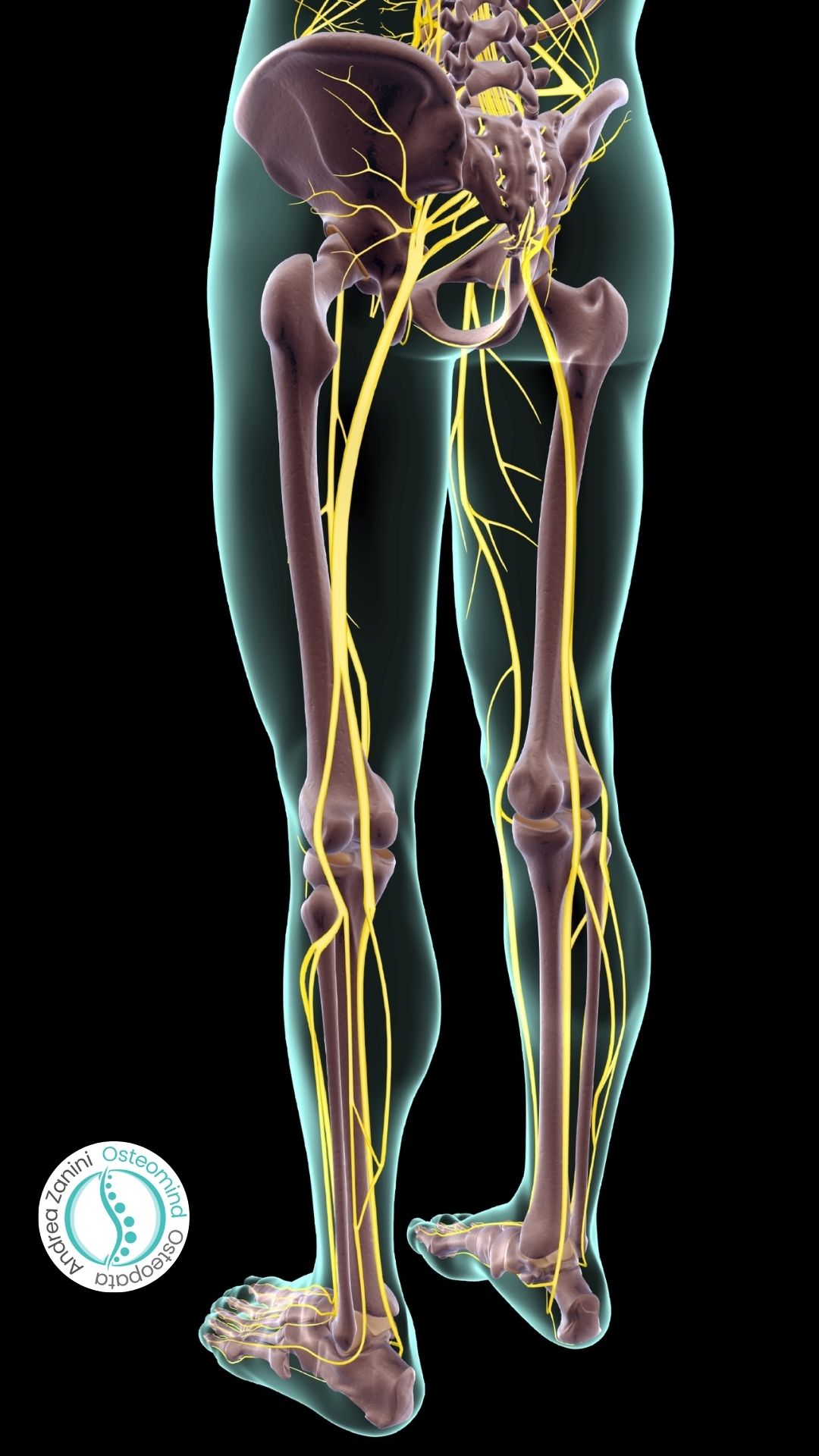 Sciatalgia acuta Milano