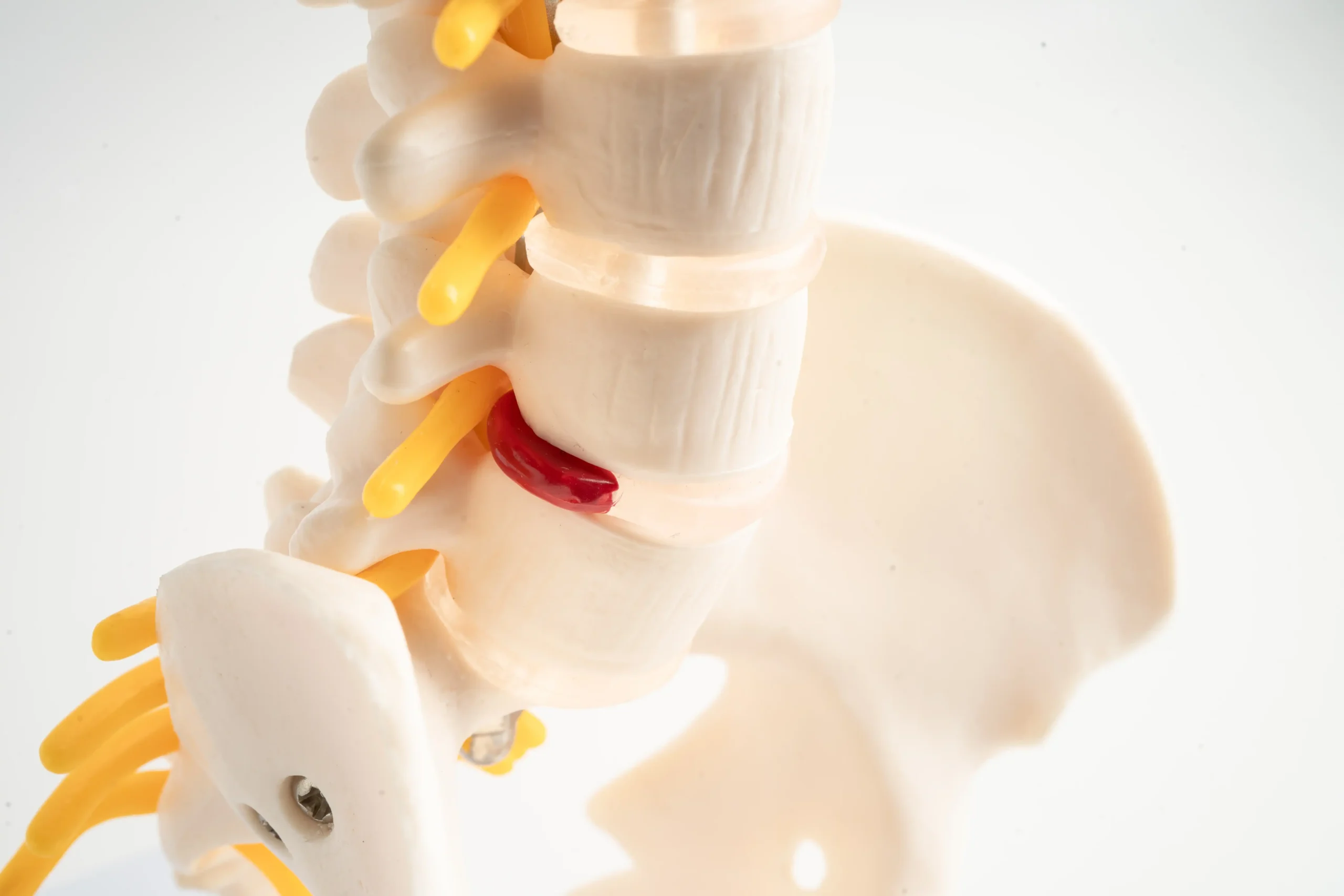 trattamento osteopatico per ernia del disco a Milano